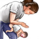 Что делать, если ребенок подавился? Что делать, если ребенок подавился?